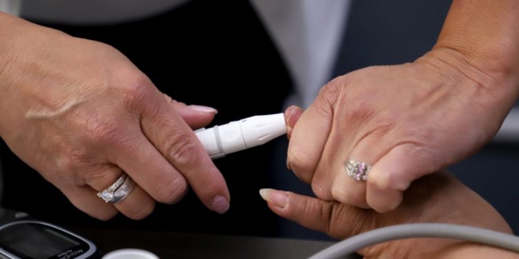 Hipertensión, obesidad y diabetes, principales comorbilidades en pacientes COVID-19