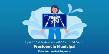 Inicia campaña “Huesos y Articulaciones Sin Dolor” en Quiroga
