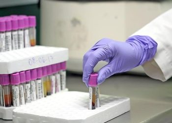 Promueve IMSS Michoacán la detección oportuna de la hemofilia para mejorar calidad de vida